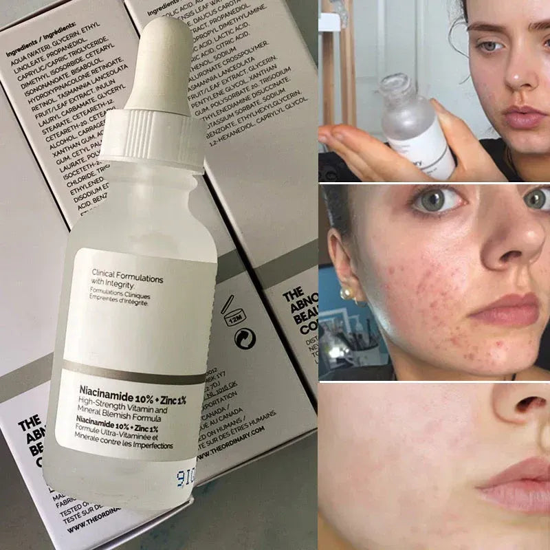 The Ordinary Niacinamide 10% + Zinc 1% | Mejora la textura y unifica el tono de la piel