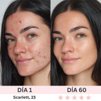 GLOWIA ESCULTOR FACIAL LED TERAPIA ✨