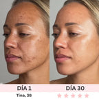 GLOWIA ESCULTOR FACIAL LED TERAPIA ✨